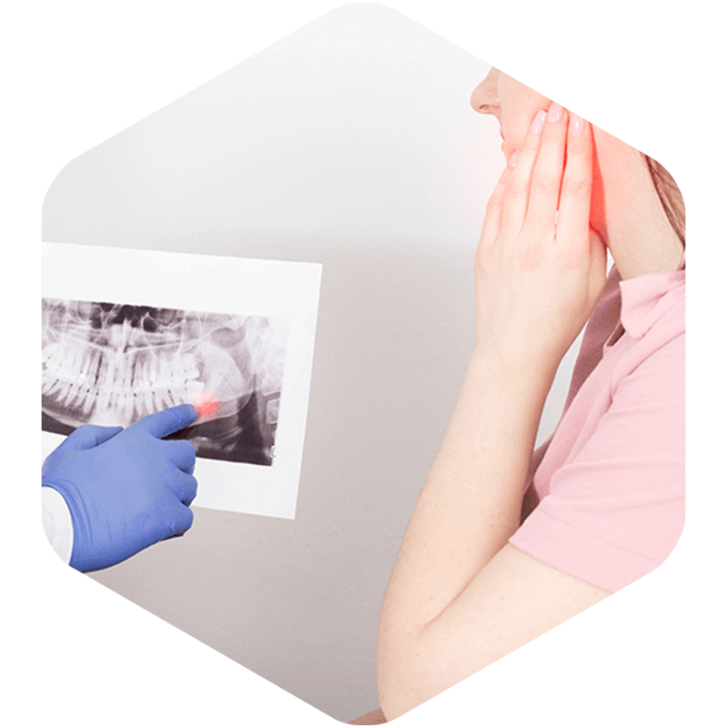 Woman with wisdom tooth pain and doctor's arms showing her a panoramic view of where the pain is located.